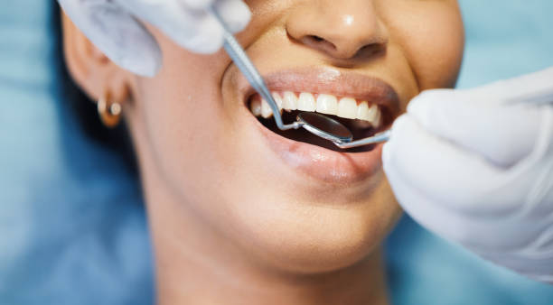 Best Emergency Dentist for Lost Fillings or Crowns in Williamsport, MD